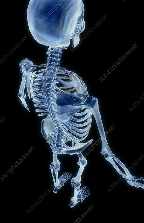 The bones of the neck and shoulder - Stock Image - C008/0810 - Science