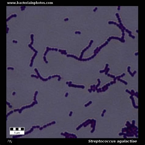 Streptococcus Agalactiae Under Microscope Group B Streptococcus Or Gbs Microscopy Of Gram