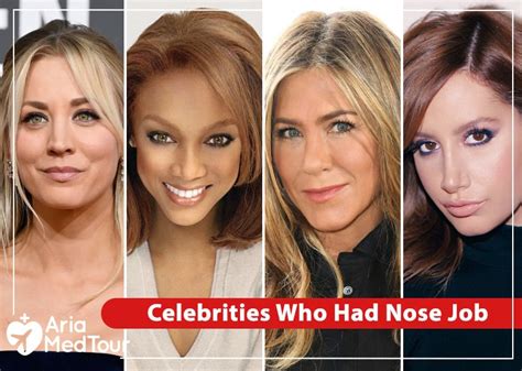 Nose Job Before And After Celebrities