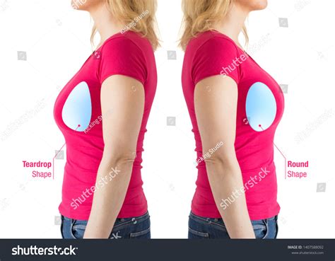 Woman Illustrations Round Teardrop Shaped Breast 스톡 사진 Shutterstock
