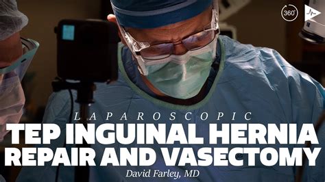 Laparoscopic Tep Inguinal Hernia Repair And Vasectomy By David R My