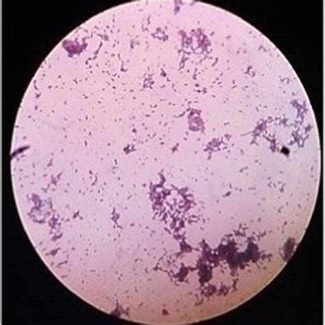 Gram Staining Results Showing Gram Positive Rod Shaped Bacteria