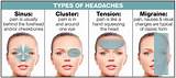 Photos of What Causes Severe Headaches On One Side Of The Head