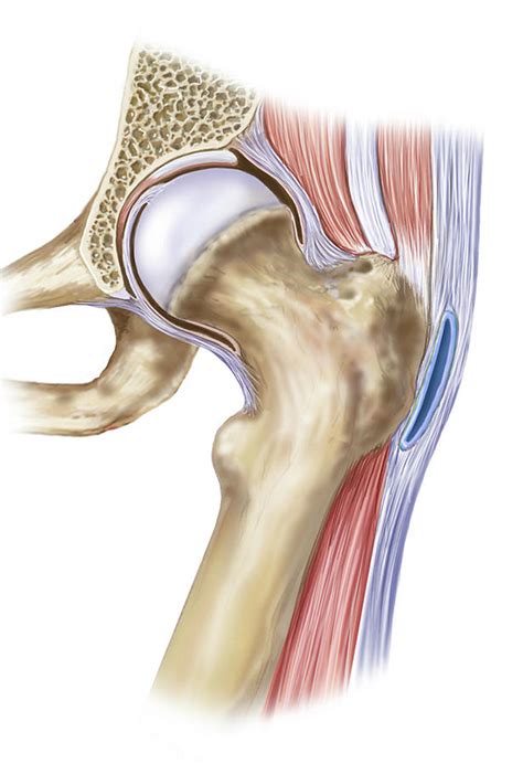 Hip Joint Showing Greater Trochanter Photograph By Elise Walmsley Mac