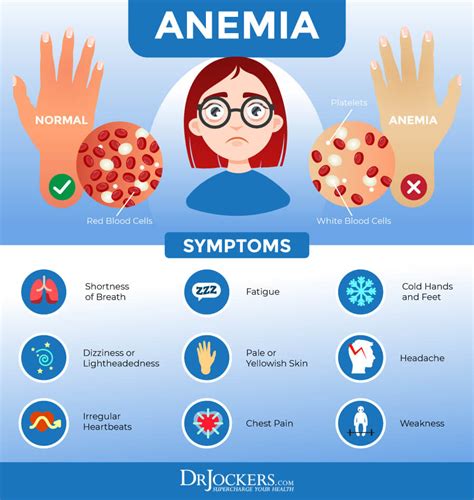 Anemia Overview Types Causes Signs And Symptoms Treatment