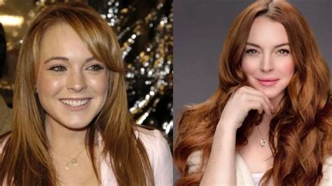 Lindsay Lohans Plastic Surgery Before And After Pictures Evaluated