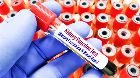 Hyperphosphatemia in Chronic Kidney Disease: Causes, Symptoms, & Management