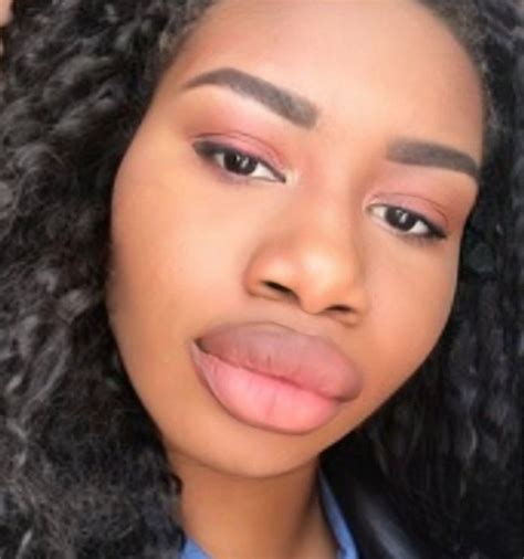 labios gruesos africanos labio gato inchado