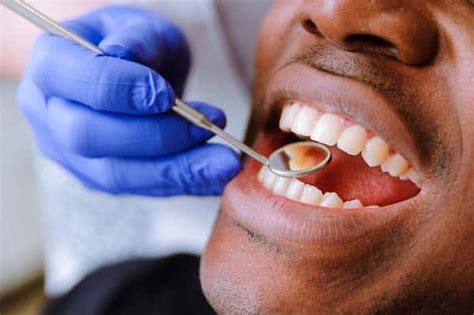How Dentists Use Dental Crowns In Cosmetic Dentistry Scottsdale