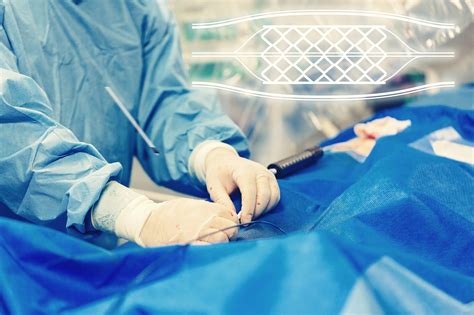 Better Outcomes With Early Cabg Vs Pci In Patients With Ischemic Heart