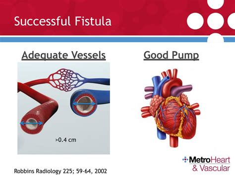 Ppt Arteriovenous Fistulas Types Trends Physical Examination Treatment Powerpoint