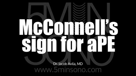 Should We Use Mcconnells Sign For Acute Pe Youtube