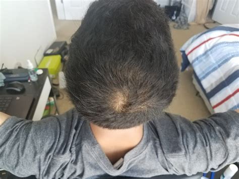 When the hair is short on the side and back, it gives the illusion that is the hair is thicker and fuller at the top. short2.jpg