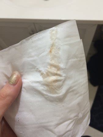 This is because most women tend to have some kind of discharge especially throughout their first trimester. Brown discharge when wipe vagina - XXX photo