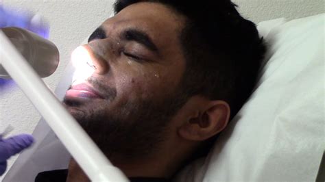 Nasal Splint Removal After Rhinoseptoplasty Youtube