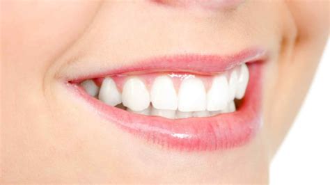 7 Richtlijnen Voor Gezonde Tanden Cmt Aarschot