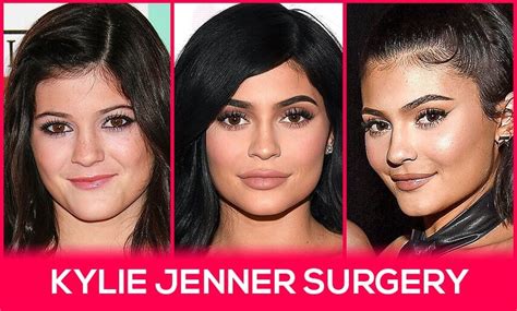 Kylie Jenner Surgery Procedures And Rumors With Pictures Vera Clinic