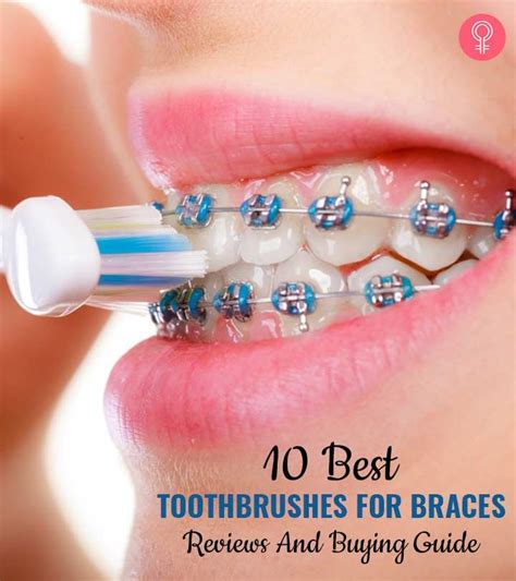 10 Best Toothbrushes For Braces 2022 Reviews And Buying Guide Brushing Teeth Orthodontic