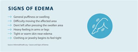 How To Treat Edema Blisters Tactile Medical