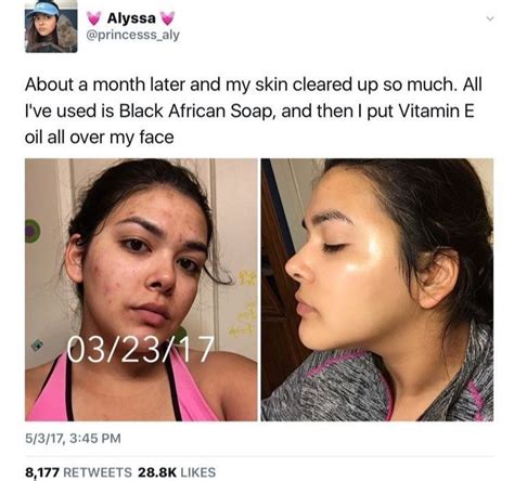 Skin Care Routine For Acne Do You Want The Finest Tried And True Skin