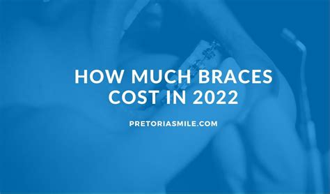 Cost Of Braces In South Africa I 2022 Pretoriasmile Orthodontics