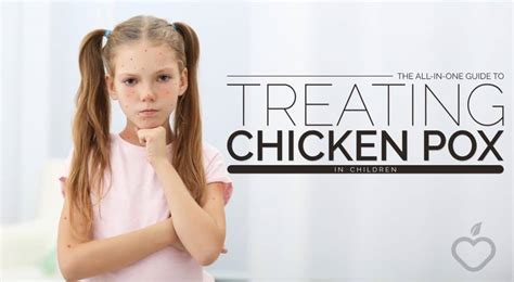 The All In One Guide To Treating Chicken Pox In Children Positive
