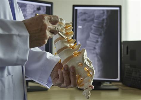 Reasons For Revision Spine Surgery Orthopedics Associates