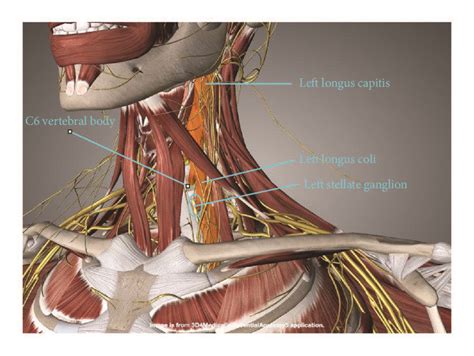 Relationship Of The Stellate Ganglion To The Longus Colli The Stellate