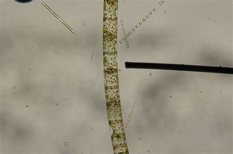 Dsc02831 Bowery Bay Diatoms 100x Biopocketgopher Flickr