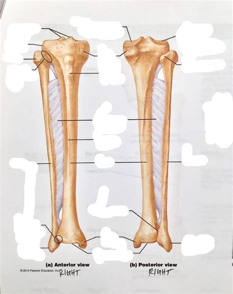Tibia And Fibula Right Anterior And Posterior Views Diagram Quizlet
