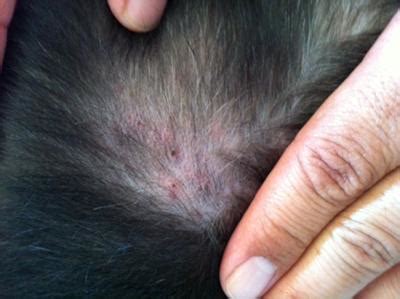 Hair loss in dogs can range from hair falling out in clumps, to bald patches with scabs. Dog Itching on Multiple Body Parts; Causing Scabs & Hair Loss