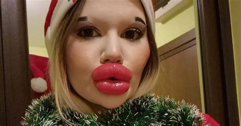 Woman With World S Biggest Lips Offers Huge Mistletoe Kiss This Xmas To Highest Bidder Daily