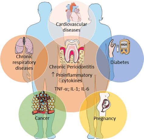 chronic periodontitis and some common systemic diseases download scientific diagram