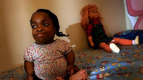 Meet Wildine Aumoithe The Shortest Woman In The World According To