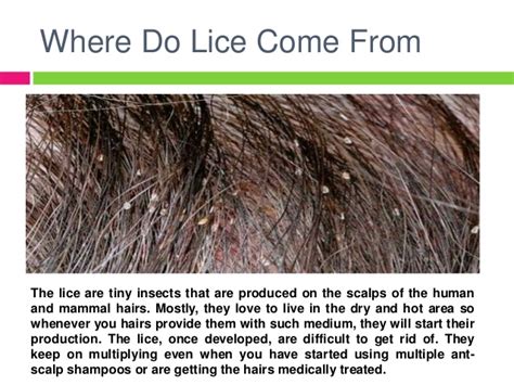Can black people get lice