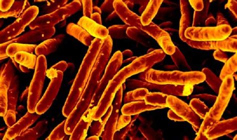 We hope the world will emerge from this tuberculosis (tb) is a global disease, found in every country in the world. Hypervirulent TB Strain Evolved in Northern China 2,000 ...
