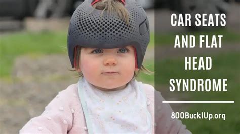 Car Seats And Flat Head Syndrome Are Seats Risky For Baby