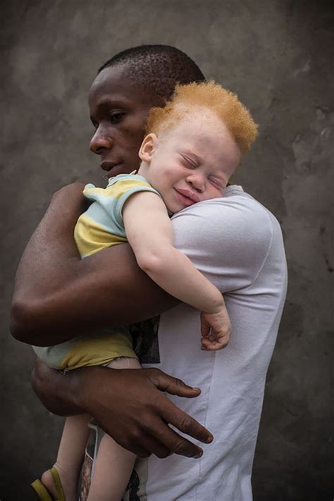 Albino People Wholl Mesmerize You With Their Otherworldly Beauty People Beautiful
