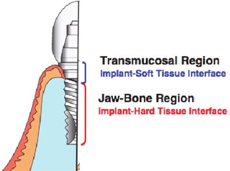 However, no clinical studies have evaluated their simultaneous effect on marginal bone loss (mbl). Schema of biological region around dental implants. A ...