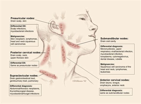 Swollen Posterior Cervical Lymph Nodes In Neck Slideshare