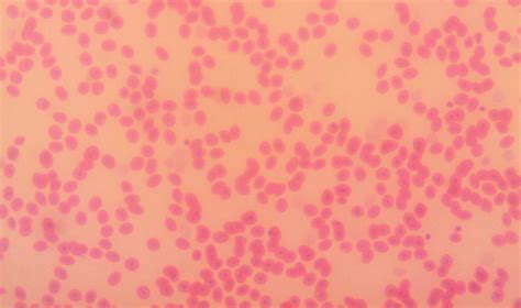 Fish Blood Smear X Microscopic Photography Microscopy Smears Blood Fish Pisces