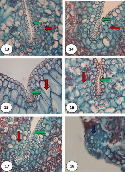 13 18 Part Of Ts Of Seedling Leaf Midrib Showing Bulliform Cells