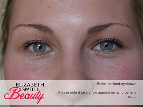 Over Plucked Eyebrows Before And After Photo My Beauty Salon Website
