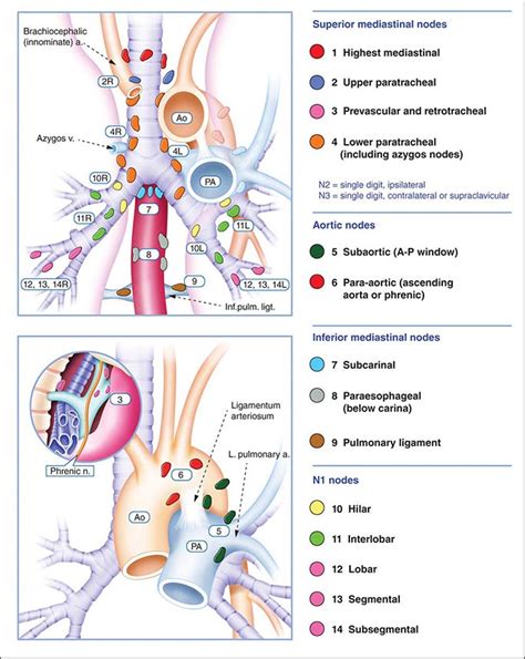 Neoplasms Of The Lung Basicmedical Key