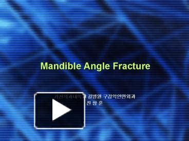 PPT Mandible Angle Fracture PowerPoint Presentation Free To View Id Bda A MzRiZ