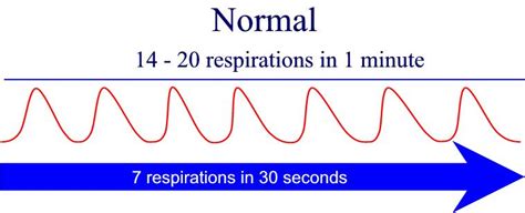 A faster than normal rate of breathing. Nursing Fundamentals II Multimedia Edition - Vital Signs