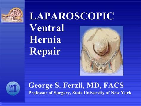 Laparoscopic Ventral Hernia Repair