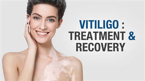 Vitiligo Treatment And Recovery Aimil Healthcare Dr Nitika Kohli