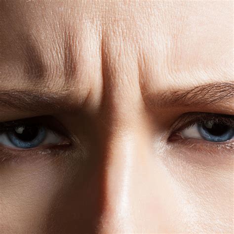 5 Types Of Wrinkles And How To Tackle Each One Newbeauty