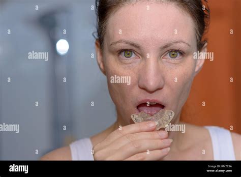 Woman Placing A Bite Plate In Her Mouth To Protect Her Teeth At Night From Grinding Caused By